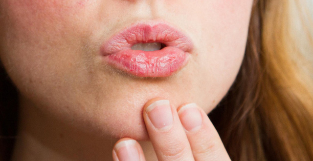 Những nguyên nhân gây ngứa môi và cách khắc phục hiệu quả